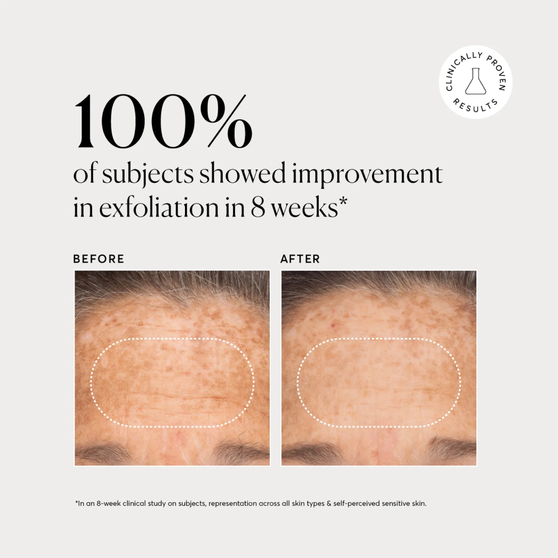bha-liquid-exfoliant-2-j2 NATR-10027-Alt-Images-BHA-Liquid-Exfoliant-2_-03.webp