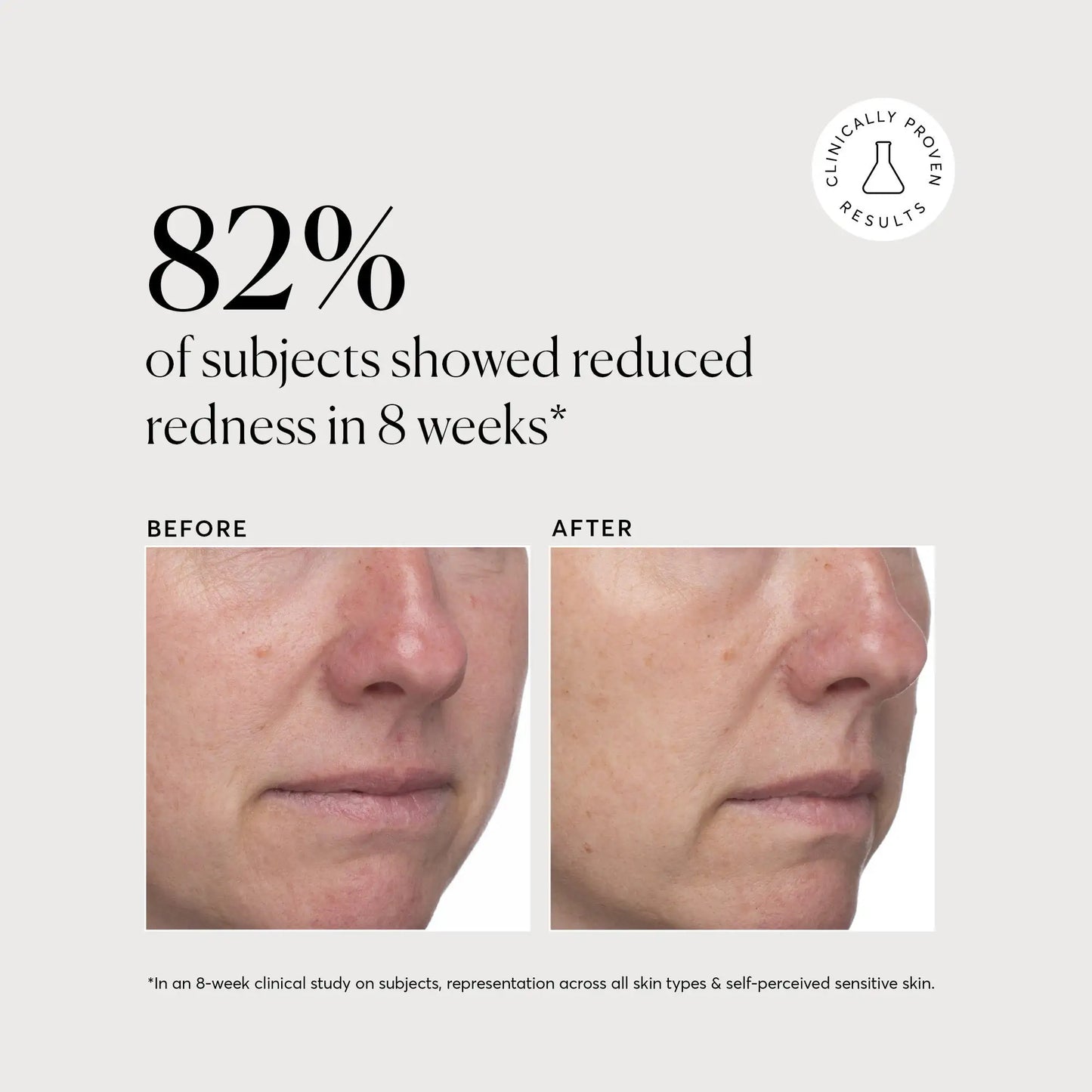 azelaic-acid-derivative-complex-10-jumbo-q9 NATR-10098-Alt-Images-Azelaic-Acid-Derivative-Complex-10_-Jumbo-05.webp